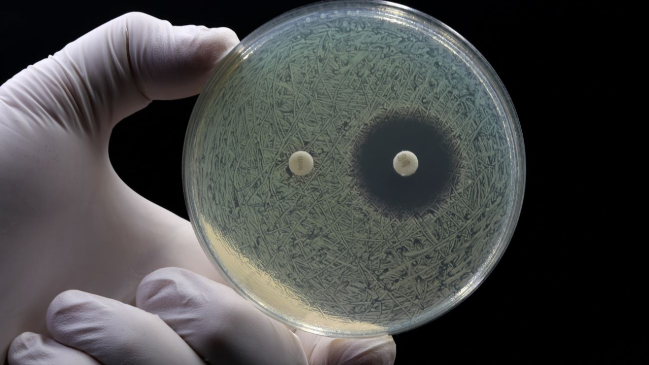 antimikrobiyal-diren-ara-t-rmas-2050-y-l-na-kadar-40-milyon-ki-i