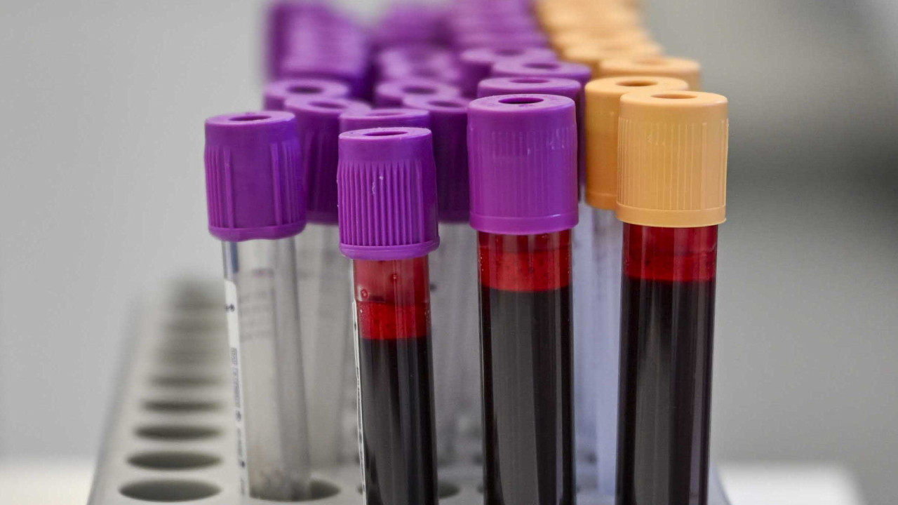 Talepler 7 kat arttı: İşe alımlarda “madde testi” dönemi