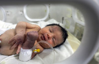 Suriye'de deprem sonrası enkazda doğan Eye bebek anne ve babasız büyüyecek