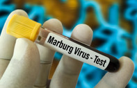 DSÖ: Marburg virüsü için 4 aşının deneme protokolleri hazır