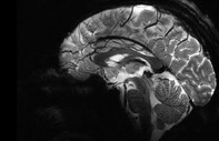 Dünyanın en güçlü MRI cihazıyla çekilen insan beyninin en net görüntüsü yayınlandı