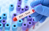 Kemik iliği nakli ile HIV'den tamamen kurtuldu