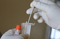 PCR testi yaptırmadan salgını nasıl takip edeceğiz?