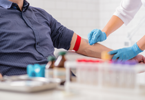 Kan testinde hangi değer ne anlama geliyor?