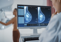 Meme kanseri vakaları 2050’de 3,5 milyonu aşabilir: Kanserden korunmak için ne yapmalı?