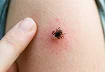 Uzmanlar uyardı: Yoğun yağışla geçen kış mevsimi kene popülasyonunu artırabilir