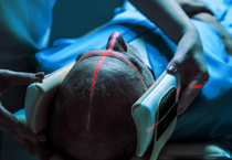 Tıp dünyasının yeni tartışması: 'Radyologların yerini yapay zeka alabilir'