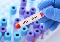 Kemik iliği nakli ile HIV'den tamamen kurtuldu