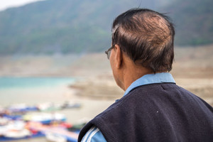 Erkek tipi saç dökülmesinde devrim: Yeni ilaç saç çıkışını yüzde 539 artırdı