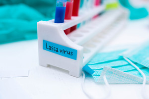 Nijerya'da Lassa ateşi nedeniyle ölenlerin sayısı 70'e yükseldi