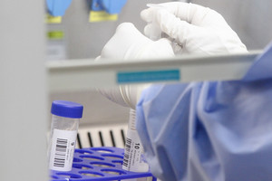 BBC yazdı: Kanser tedavileri, immünoterapiyle beraber çağ atladı