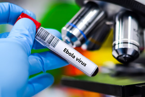 Kongo Demokratik Cumhuriyeti'nde 900'den fazla şüpheli Ebola vakası görüldü