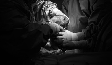 Sezaryende neden dünya birincisiyiz?