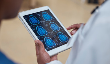 Beyin yaşlanmasında 44 ve 67’ye dikkat edin