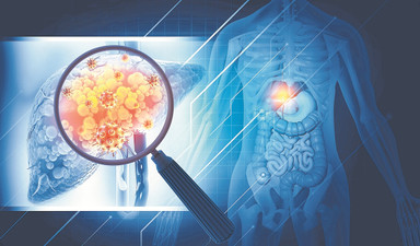 Yaygın ve sinsi tehlike: Karaciğer yağlanması