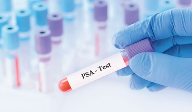 Erkekler dikkat!: PSA’ya güvenmeyin