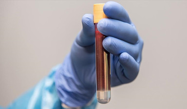 ‘Genç kanı’ gençleştirir mi?: Vampire değil bilime sor