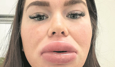 Bu anatomik felaketler neden arttı?