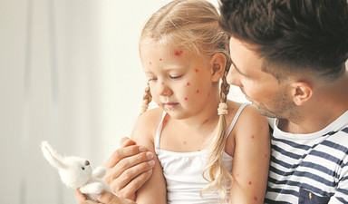 Tek doz yetmiyor, suçiçeği vakaları artıyor