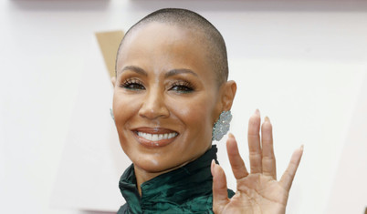 Oscar'da Smith'in Rock'a tokatı sonrası gündeme gelen alopesi (saçkıran) hastalığı nedir?