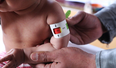 Save The Children: Bu yıl en az 17,6 milyon çocuk açlık içinde doğacak