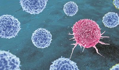 Laboratuvardaki tesadüfi keşif: Ses dalgalarıyla kansere tedavi umudu