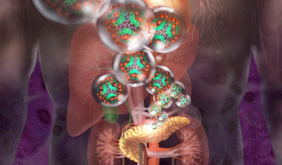 Tip 1 diyabette çığır açan hücre nakli: Artık bağışıklık baskılayıcı ilaç gerekmeyecek