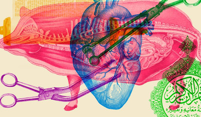 New York Times: Domuz organlarının nakli Yahudi ve İslam dünyasında tartışma yaratıyor