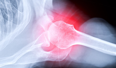 New York Post: Çinli bilim insanları 3 dakikada kırıkları onaran kemik yapıştırıcısı geliştirdi