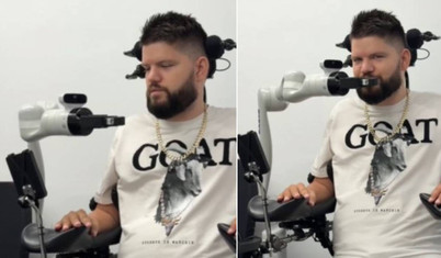 Neuralink'in beyin çipini takanlar robot kolları kontrol etmeye başladı