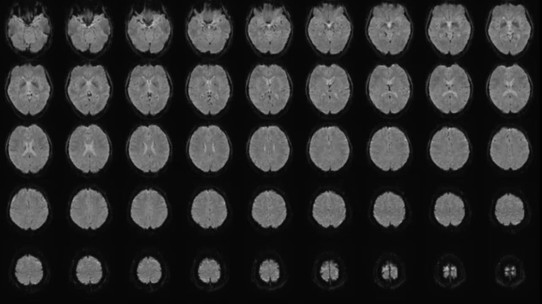 Zihin okuma gerçek oldu: Yapay zeka artık düşünceleri metne çevirebiliyor