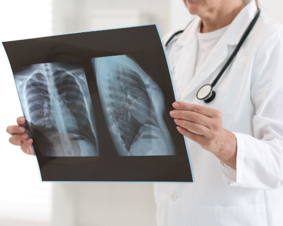 Türk bilim insanından FDA onaylı akciğer kanseri ilacı