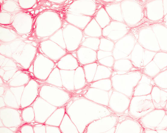 Lenf sistemi: Vücudun gizli detoks gücü