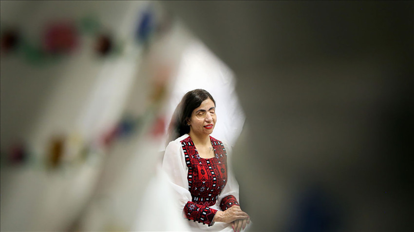 İranlı modacı asit saldırısına uğrayan kadınları model olarak çalıştırıyor
