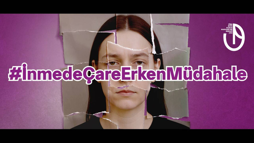 İnmede çare erken müdahale