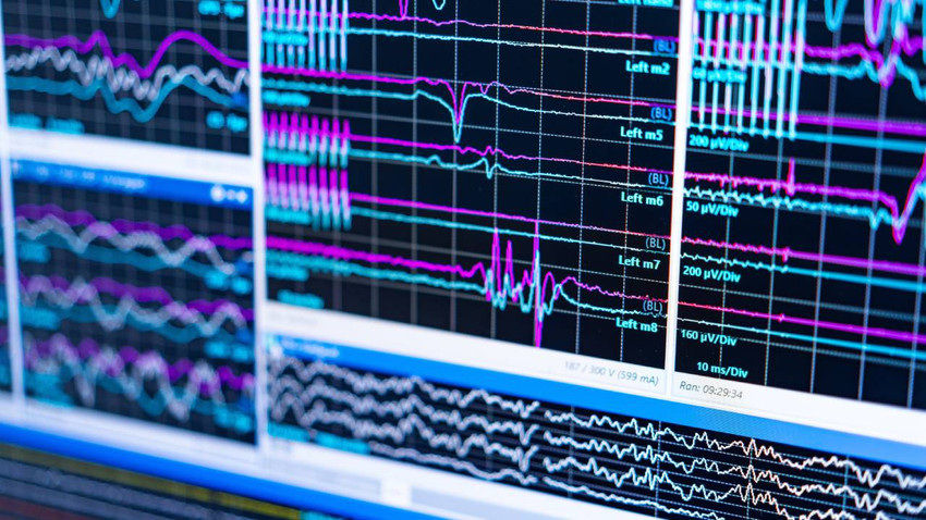 Harvard’dan çığır açan araştırma: Alzheimer'ı tersine döndürmek 'lityumla' mümkün