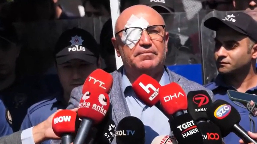 Mahmut Tanal: Gözlüğüm olmasaydı göz kaybım kesindi