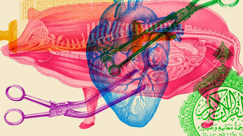 New York Times: Domuz organlarının nakli Yahudi ve İslam dünyasında tartışma yaratıyor