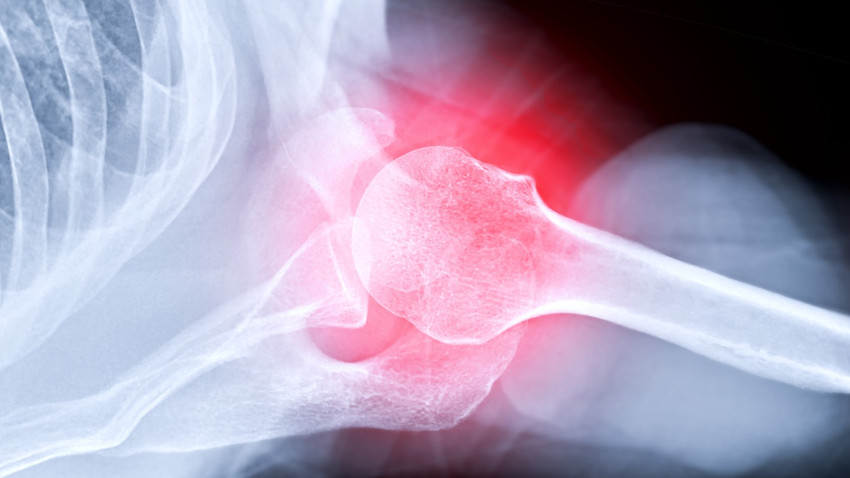 Fotoğraf: ShutterStock