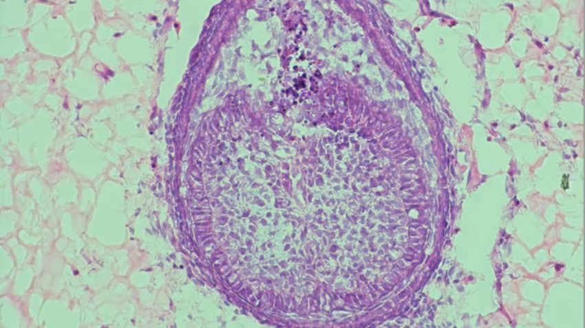 CNN International 20 yıllık çalışmayı yazdı: İnsan ve fare hücrelerinden diş geliştirildi