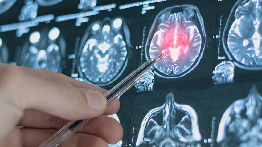 Beyin hayat boyu 5 evreden geçiyor | Dönüm noktaları: 9, 32, 66 ve 83. yaş