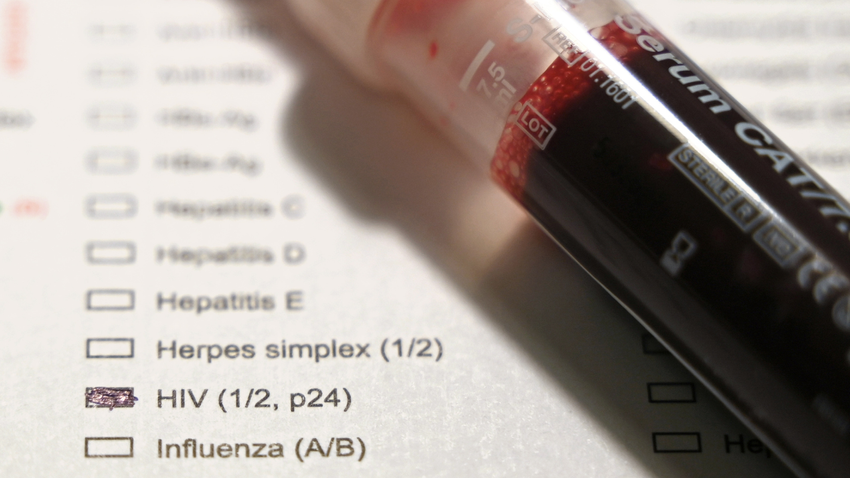 HIV'e karşı etkili ilaç Afrika'da ilk kez halka açık uygulanmaya başladı