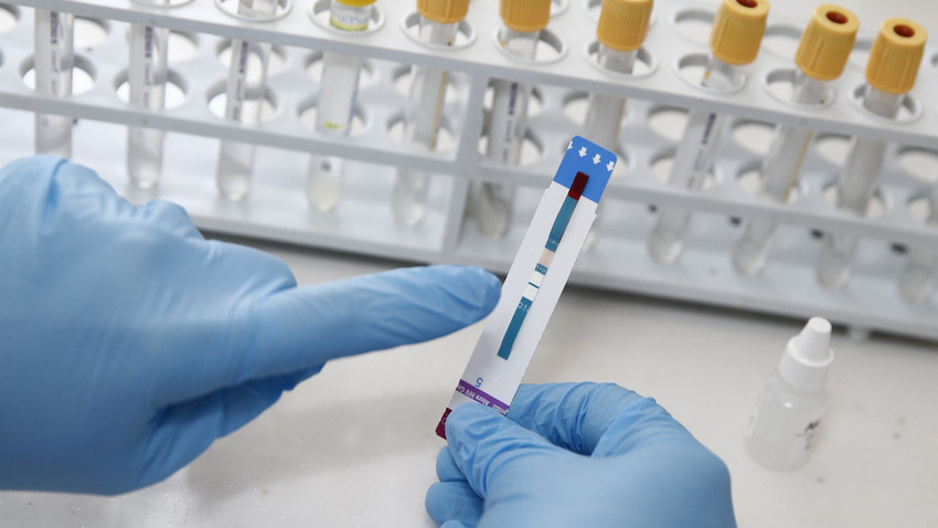 HIV tedavisinde ezber bozan vaka: Kök hücre nakli hastalığa çözüm olabilir mi?