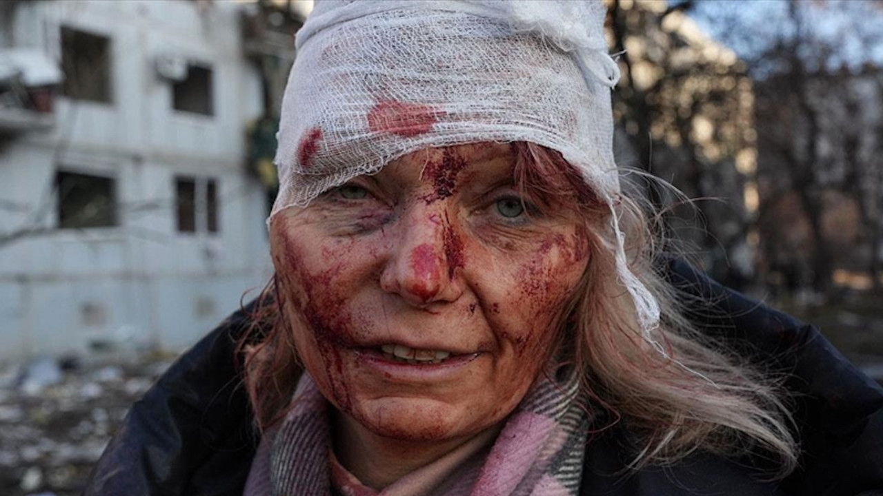 İlk günden savaşın sembolü oldu (En sarsıcı fotoğraf)