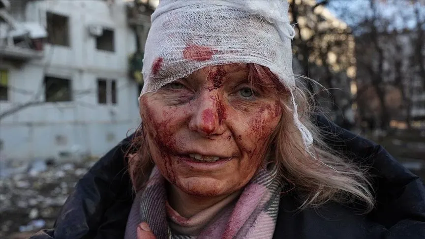 İlk günden savaşın sembolü oldu (En sarsıcı fotoğraf)