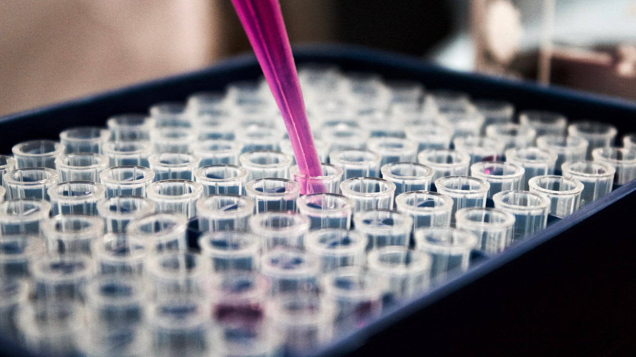 Ancestry DNA testini 54 yeni pazara genişletiyor