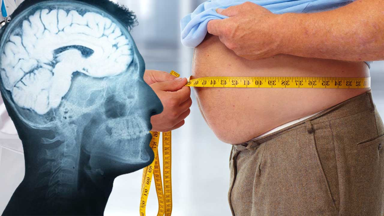 Obezite beyni kemiriyor, görüntü Alzhemier'ı hatırlatıyor