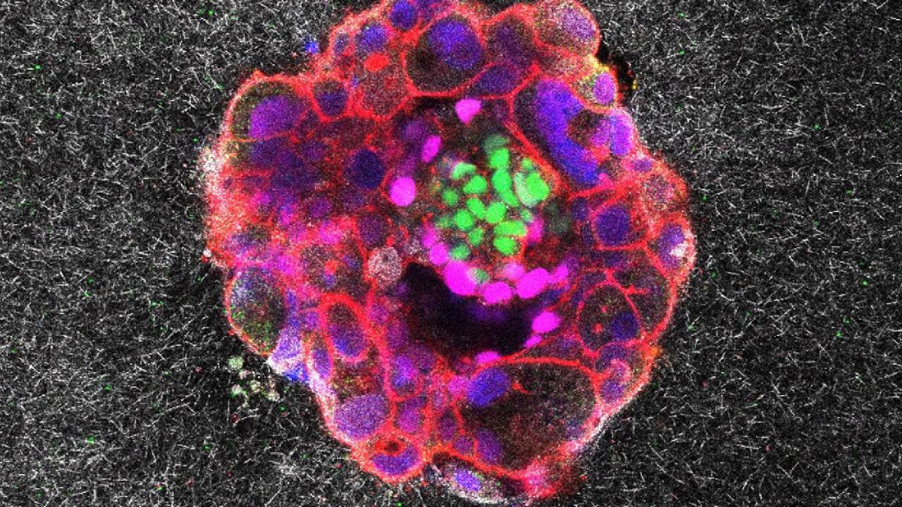 Kısırlık son bulabilir, canlı olarak izlediler: İnsanın oluştuğu ilk an kaydedildi