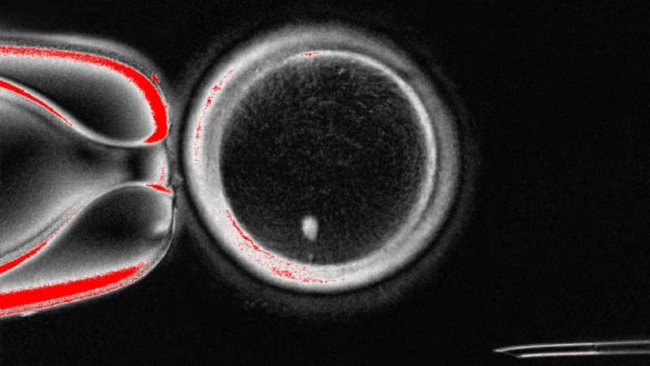 Deri hücresinden insan yumurtası üretildi | Kısırlığa yeni umut: Klonlama